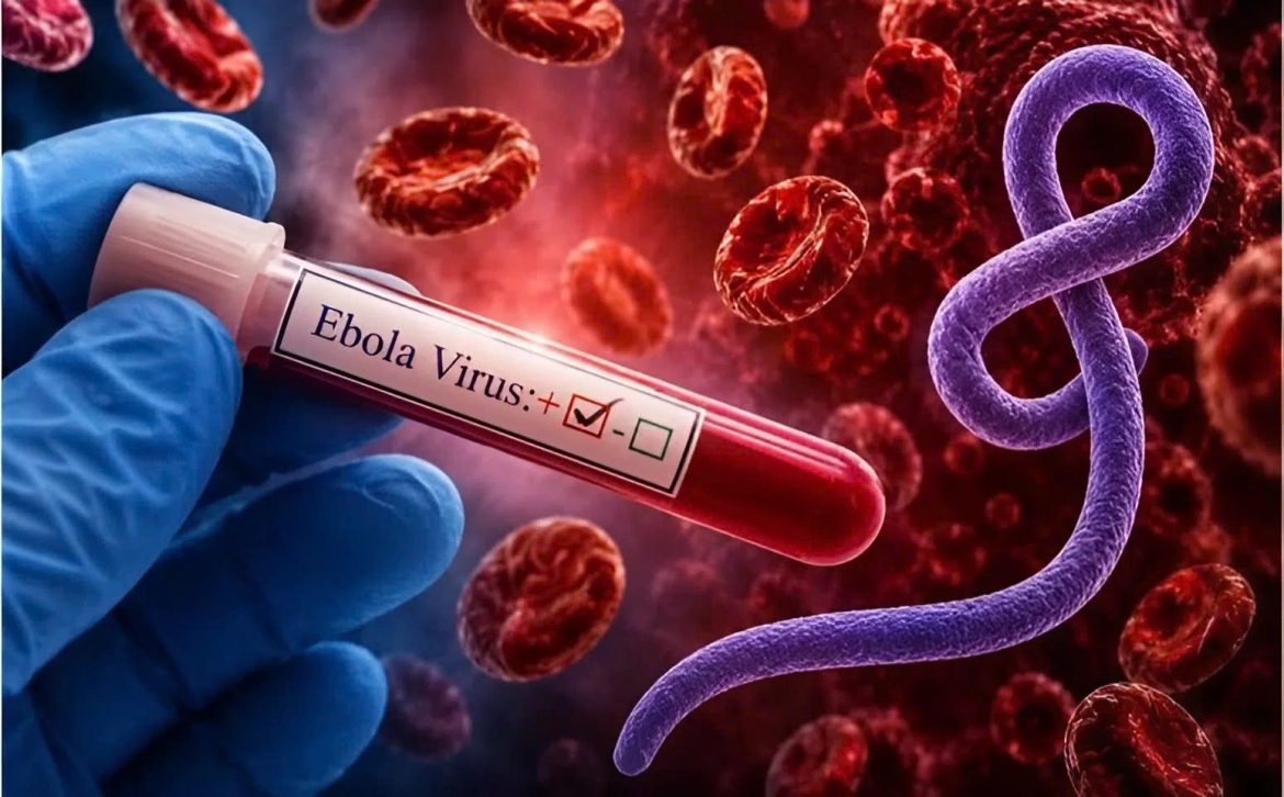 Tỷ lệ tử vong khi mắc Ebola có thể lên tới 90%